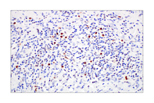 Immunohistochemistry Image 2: IRF-8 (E6J8Q) XP® Rabbit mAb (BSA and Azide Free)