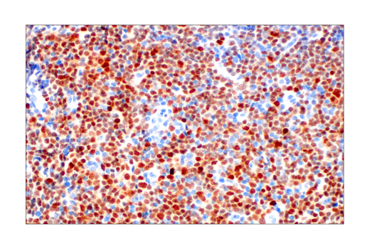 Immunohistochemistry Image 1: IRF-8 (E6J8Q) XP® Rabbit mAb (BSA and Azide Free)