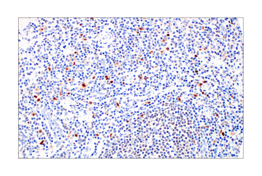 Immunohistochemistry Image 5: IRF-8 (E6J8Q) XP® Rabbit mAb (BSA and Azide Free)