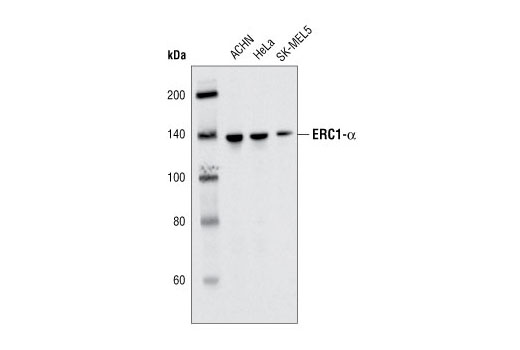 Western Blotting Image 1: ERC1α (D1055) Antibody