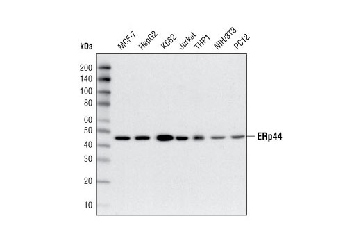 Western Blotting Image 1: ERp44 Antibody