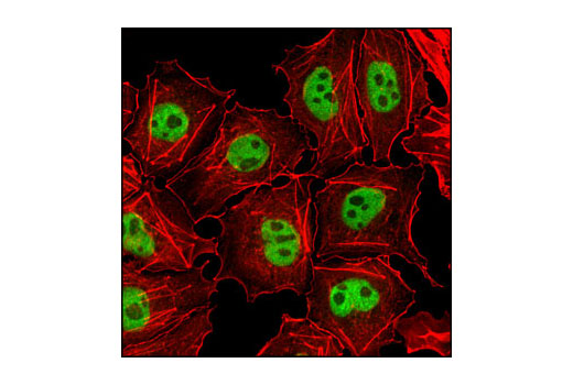 Immunofluorescence Image 1: Oct-4A (C52G3) Rabbit mAb