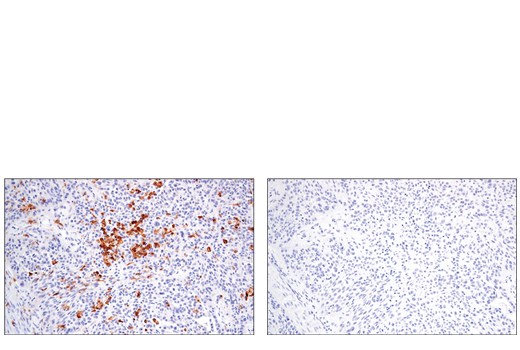 Immunohistochemistry Image 3: CSF-1R/M-CSF-R (E4T8Z) Rabbit mAb