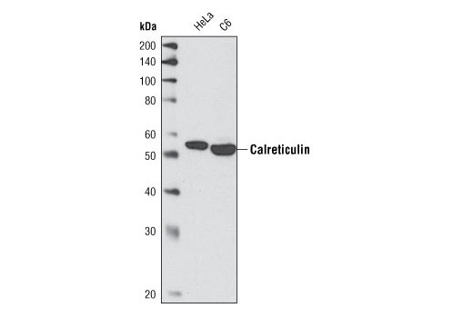 Western Blotting Image 1: Calreticulin Antibody