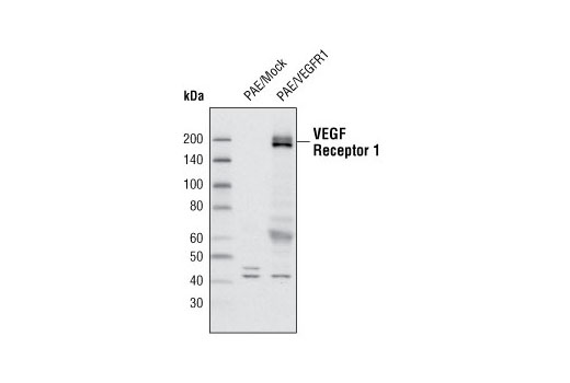 Western Blotting Image 1: VEGF Receptor 1 Antibody