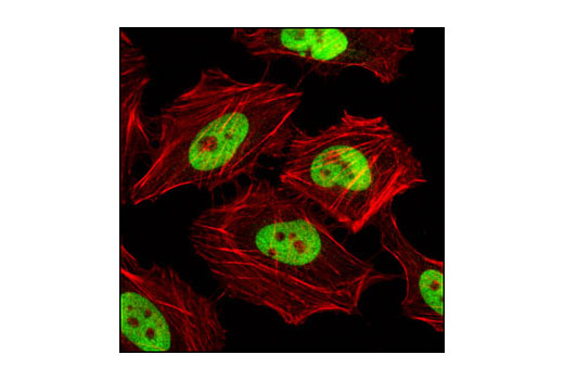 Immunofluorescence Image 1: CTCF Antibody