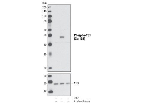  Image 1: PhosphoPlus® YB1 (Ser102) Antibody Duet