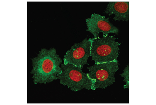Immunofluorescence Image 1: IQGAP1 (D6E3J) Rabbit mAb