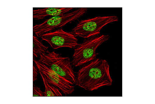  Image 29: Methyl-Histone H3 (Lys36) Antibody Sampler Kit