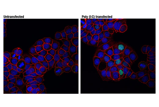 Immunofluorescence Image 1: Phospho-IRF-3 (Ser396) (D6O1M) Rabbit mAb