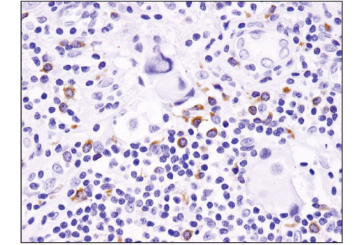 Immunohistochemistry Image 1: BLNK (D3P2H) XP® Rabbit mAb (BSA and Azide Free)