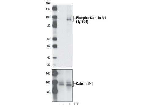 Western Blotting Image 1: Phospho-Catenin δ-1 (Tyr904) Antibody