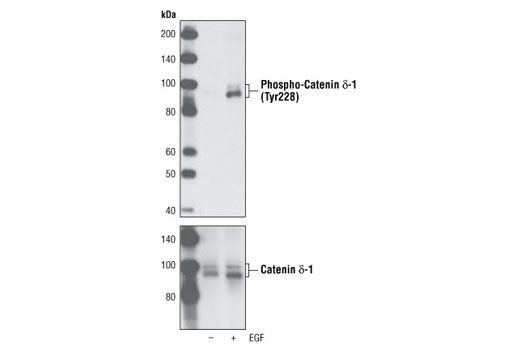 Western Blotting Image 1: Phospho-Catenin δ-1 (Tyr228) Antibody