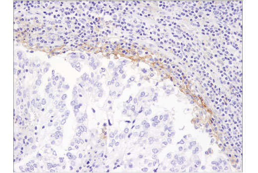 Immunohistochemistry Image 1: PD-L1 (405.9A11) Mouse mAb