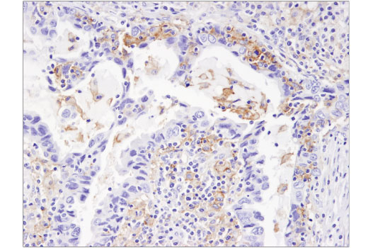 Immunohistochemistry Image 2: PD-L1 (405.9A11) Mouse mAb