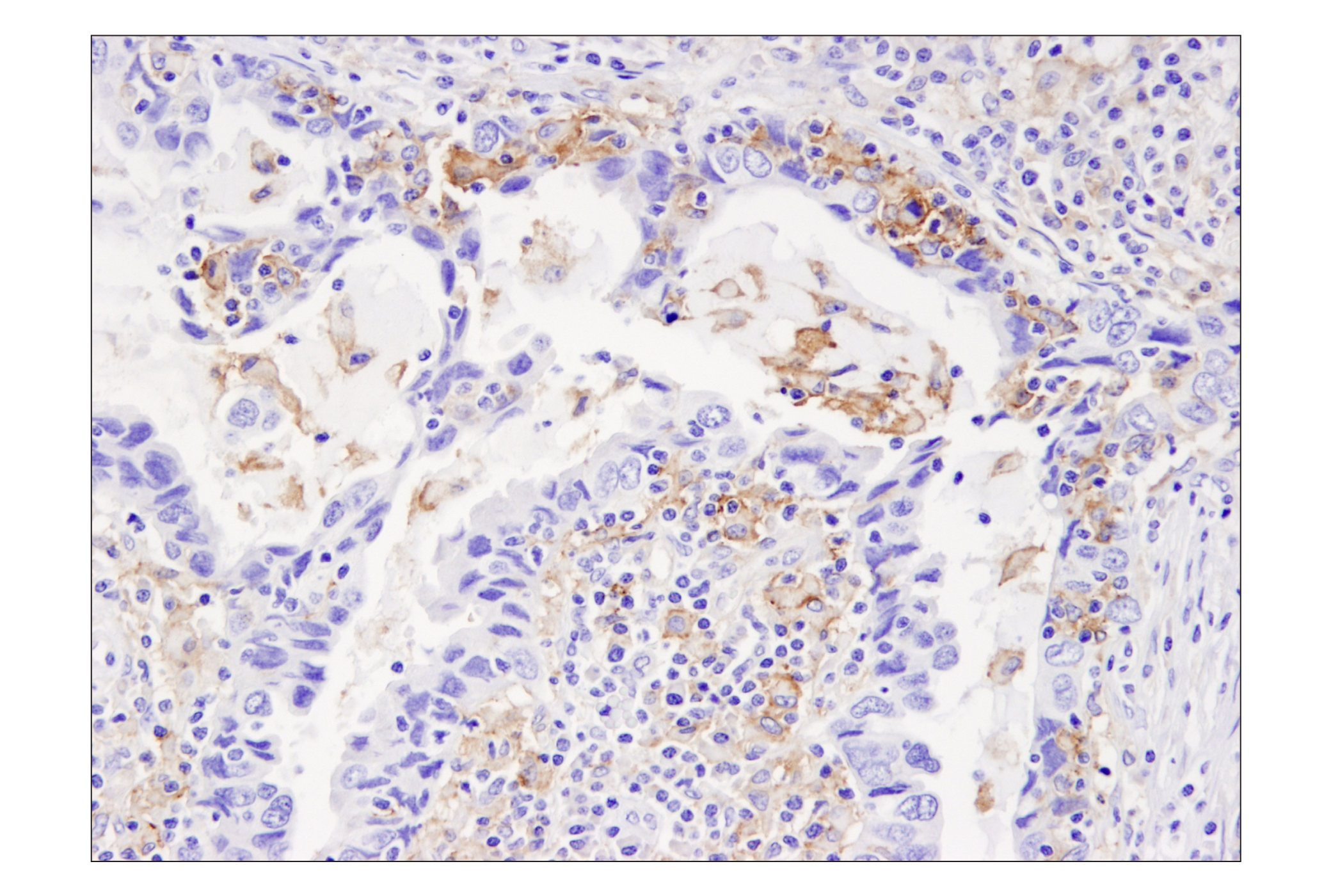 Immunohistochemistry Image 2: PD-L1 (405.9A11) Mouse mAb