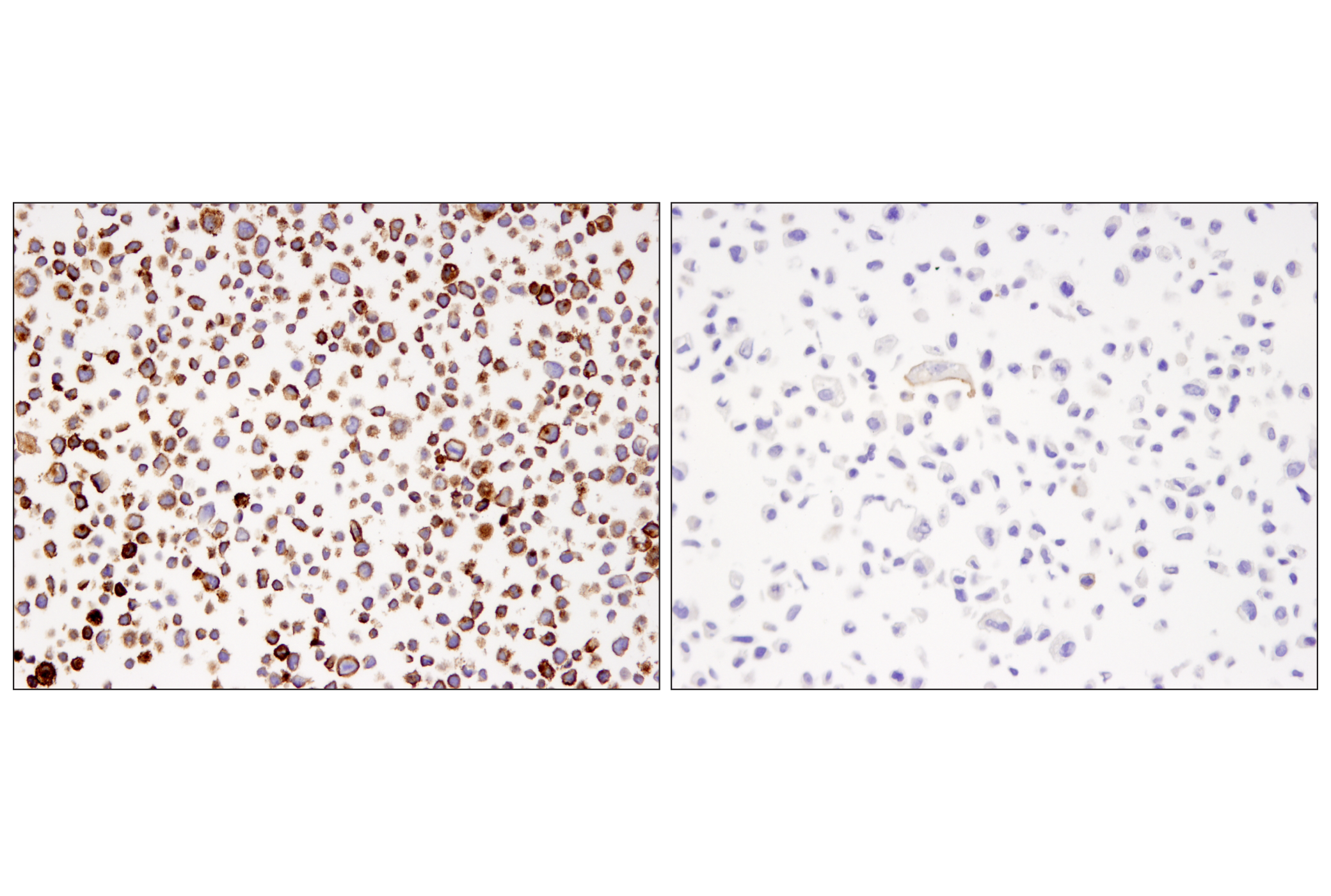 Immunohistochemistry Image 3: PD-L1 (405.9A11) Mouse mAb