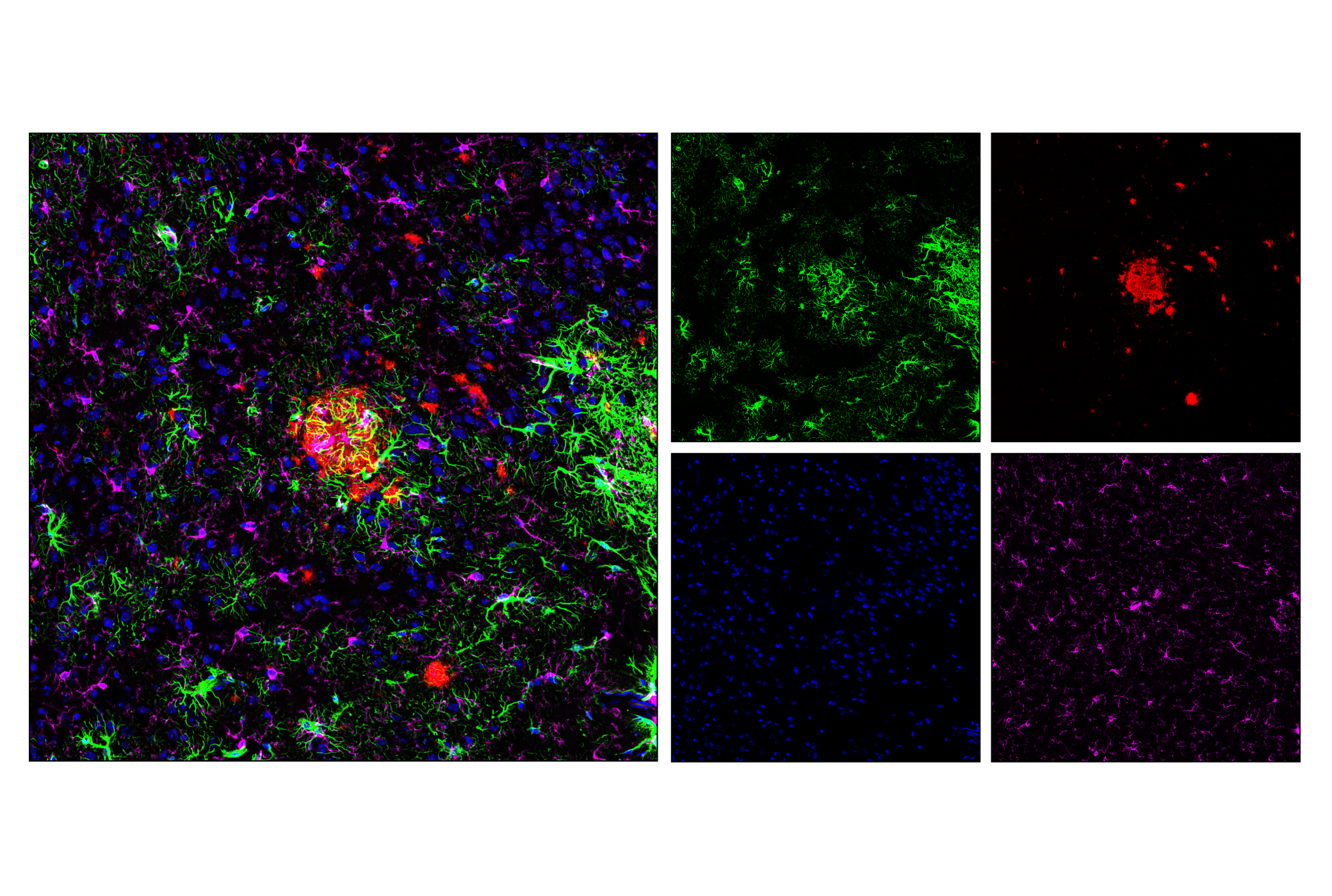 Immunofluorescence Image 1: GFAP (E6N9L) Mouse mAb (BSA and Azide Free)