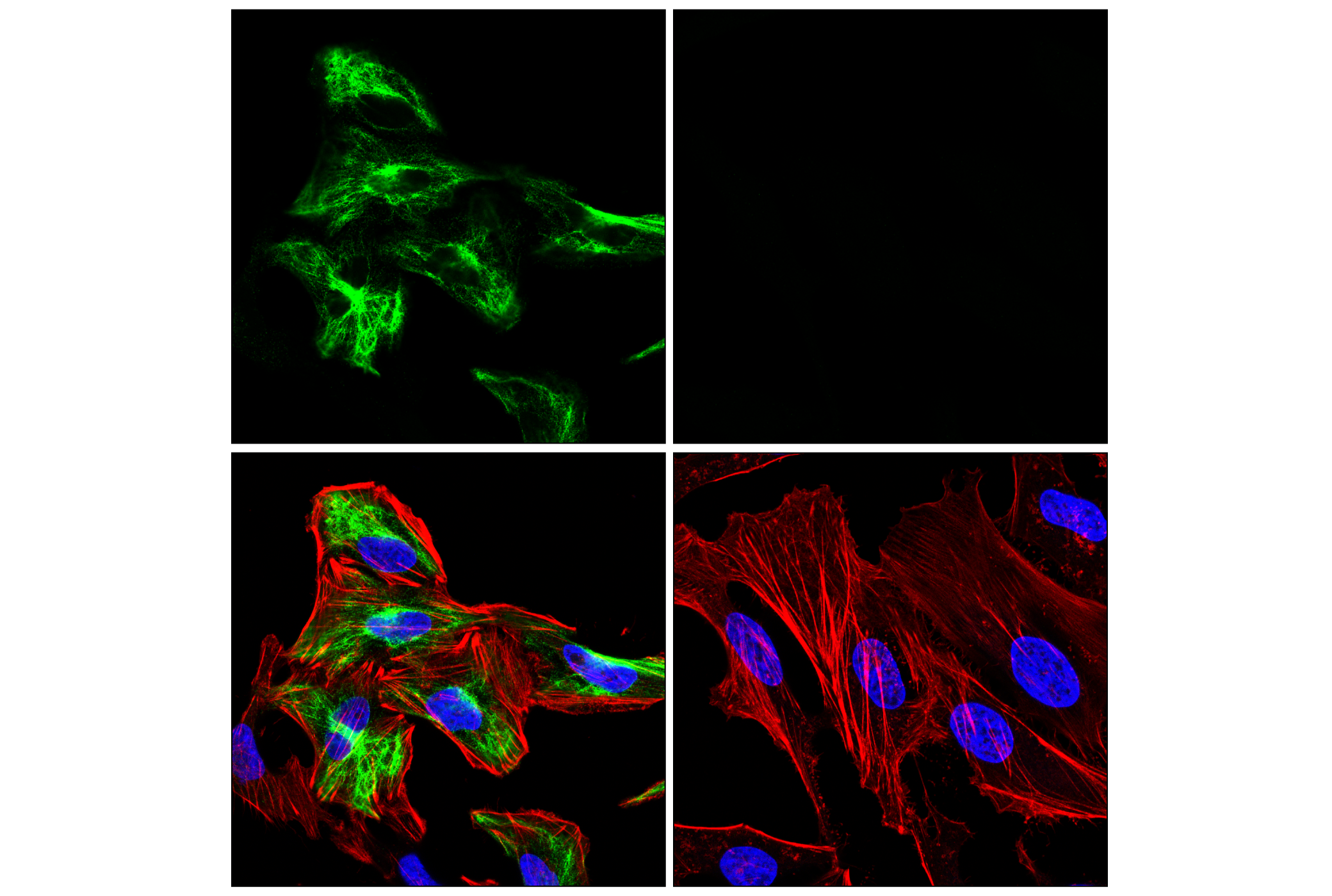 Immunofluorescence Image 2: GFAP (E6N9L) Mouse mAb (BSA and Azide Free)