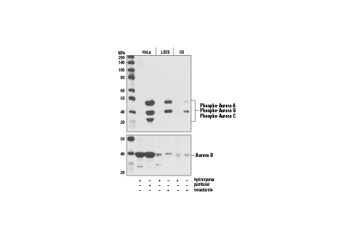  Image 2: Aurora A/B Substrate Antibody Sampler Kit