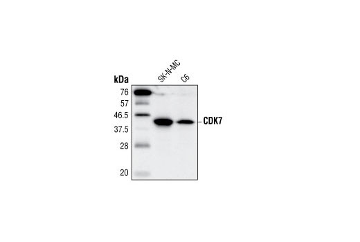  Image 5: CDK Antibody Sampler Kit
