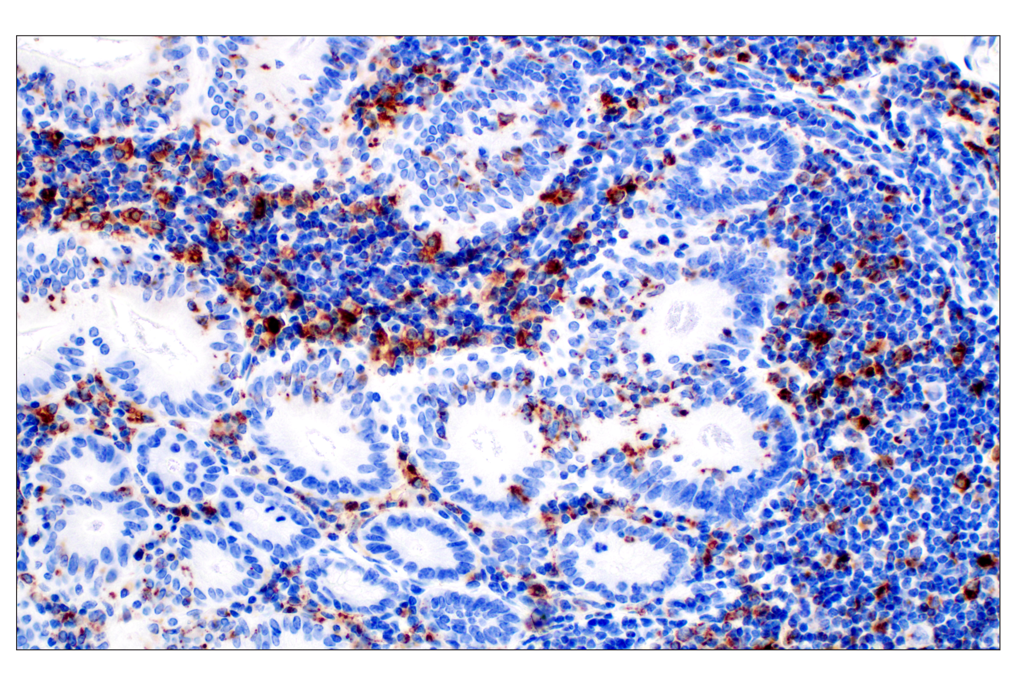 Immunohistochemistry Image 10: CD68 (E3O7V) Rabbit mAb (BSA and Azide Free)