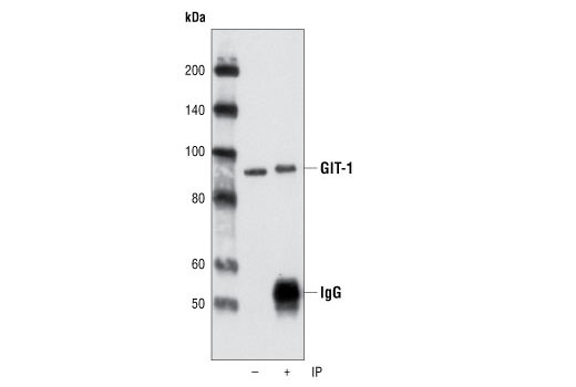 Immunoprecipitation Image 1: GIT-1 Antibody