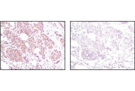 Immunohistochemistry Image 2: Akt (pan) (40D4) Mouse mAb (BSA and Azide Free)