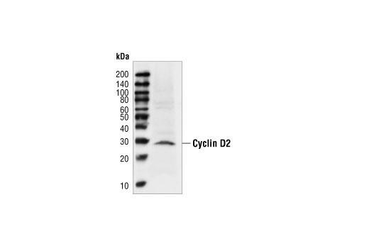 Western Blotting Image 1: Cyclin D2 Antibody