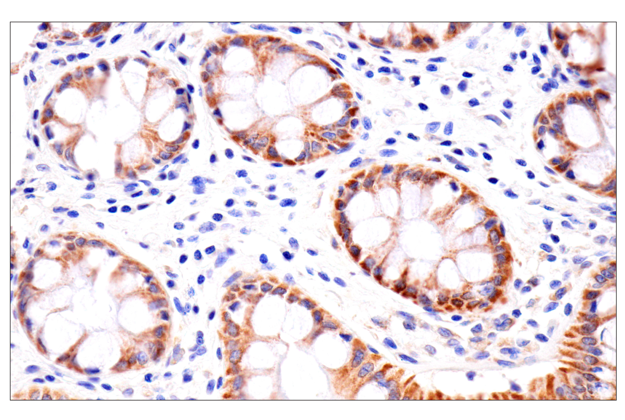 Immunohistochemistry Image 9: AMACR (F7T6V) Rabbit mAb