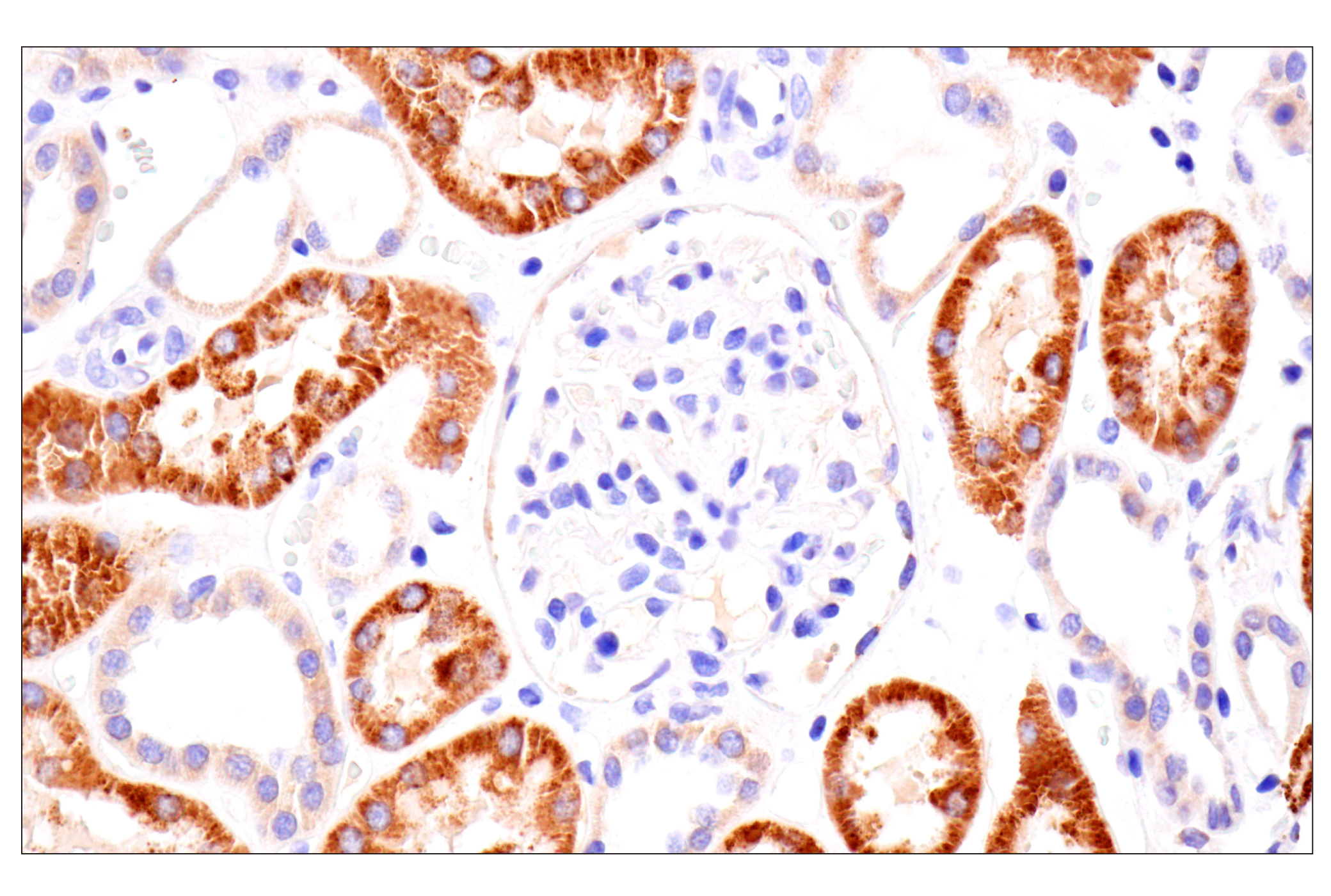 Immunohistochemistry Image 8: AMACR (F7T6V) Rabbit mAb