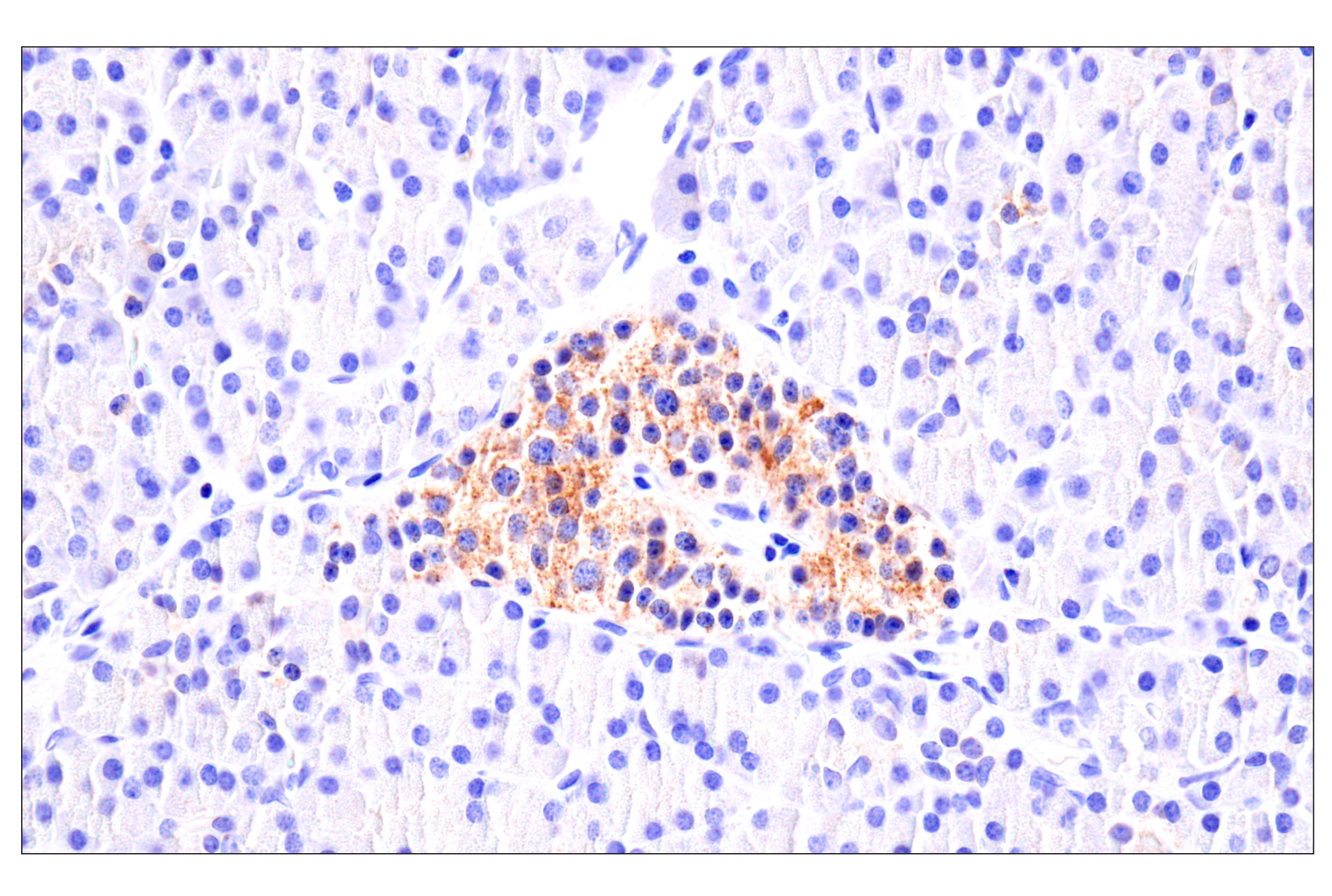 Immunohistochemistry Image 10: AMACR (F7T6V) Rabbit mAb