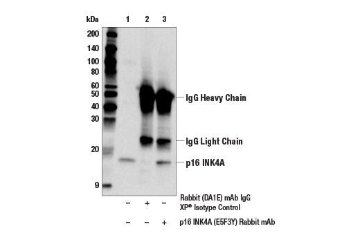 Immunoprecipitation Image 1: p16 INK4A (E5F3Y) Rabbit mAb