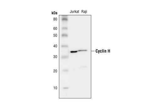Western Blotting Image 1: Cyclin H Antibody