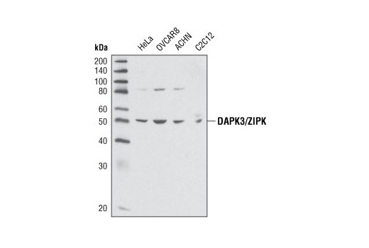 Western Blotting Image 1: DAPK3/ZIPK Antibody