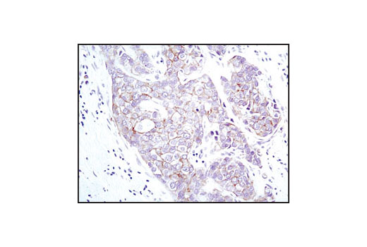 Immunohistochemistry Image 1: EpCAM (VU1D9) Mouse mAb