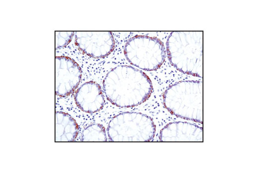 Immunohistochemistry Image 2: EpCAM (VU1D9) Mouse mAb