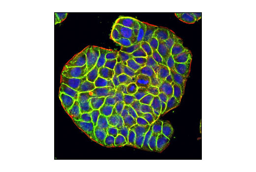 Immunofluorescence Image 1: EpCAM (VU1D9) Mouse mAb