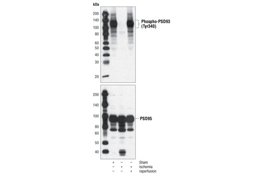 Western Blotting Image 1: Phospho-PSD93 (Tyr340) Antibody