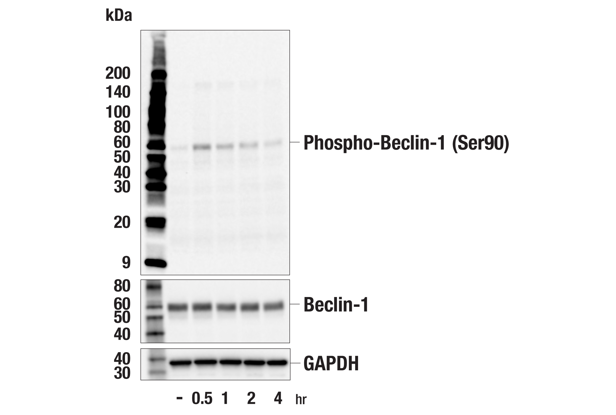 Western Blotting Image 1: Phospho-Beclin-1 (Ser90) (E3X1I) Rabbit mAb