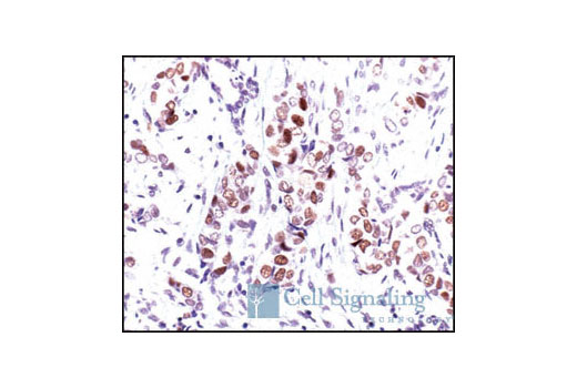 Immunohistochemistry Image 1: Cyclin D3 (DCS22) Mouse mAb