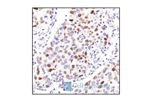 Immunohistochemistry Image 2: Cyclin D3 (DCS22) Mouse mAb
