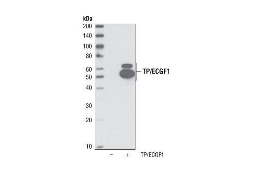 Western Blotting Image 1: TP/ECGF1 Antibody