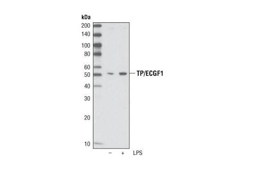Western Blotting Image 2: TP/ECGF1 Antibody