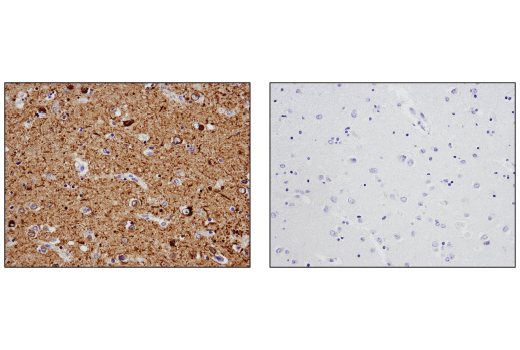 Immunohistochemistry Image 3: Tau (D1M9X) XP® Rabbit mAb (BSA and Azide Free)