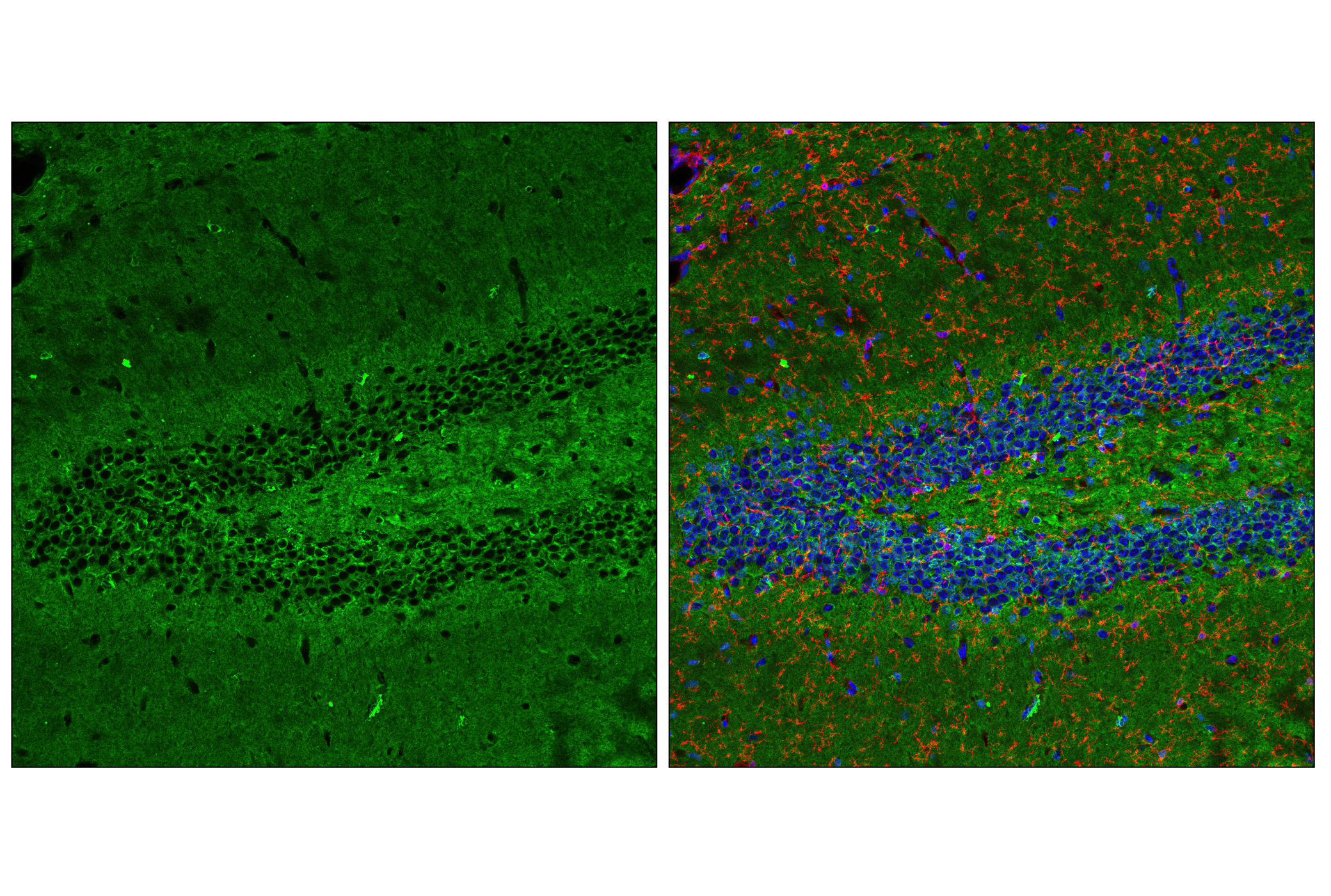 Immunofluorescence Image 1: Tau (D1M9X) XP® Rabbit mAb (BSA and Azide Free)