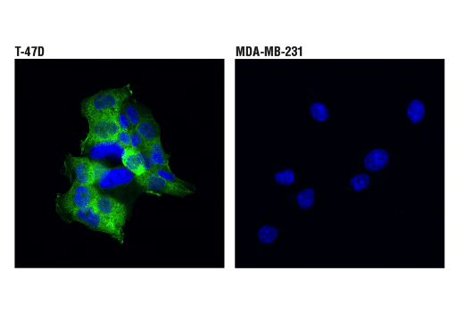 Immunofluorescence Image 2: Tau (D1M9X) XP® Rabbit mAb (BSA and Azide Free)