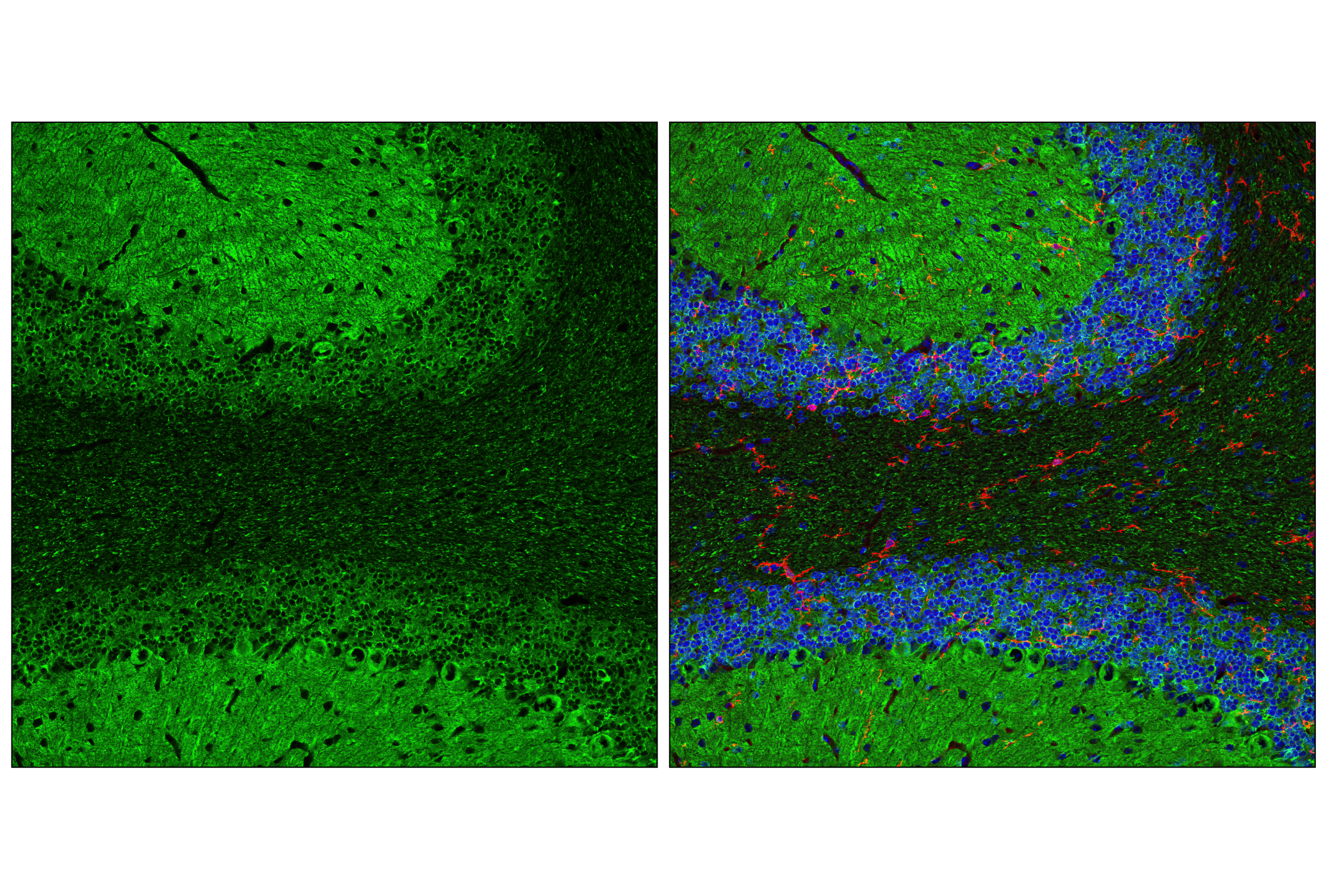 Immunofluorescence Image 2: Tau (D1M9X) XP® Rabbit mAb (BSA and Azide Free)