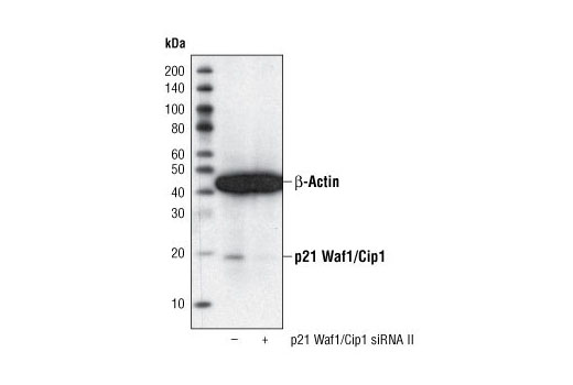  Image 22: Notch Activated Targets Antibody Sampler Kit