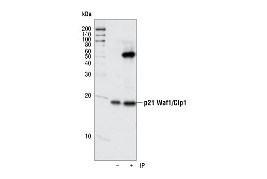 Immunoprecipitation Image 1: p21 Waf1/Cip1 (12D1) Rabbit mAb